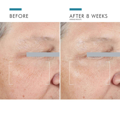 A.G.E. Advanced Eye for Dark Circles