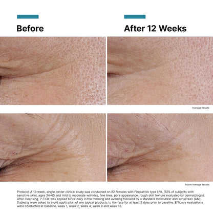 P-TIOX Anti-Wrinkle Serum