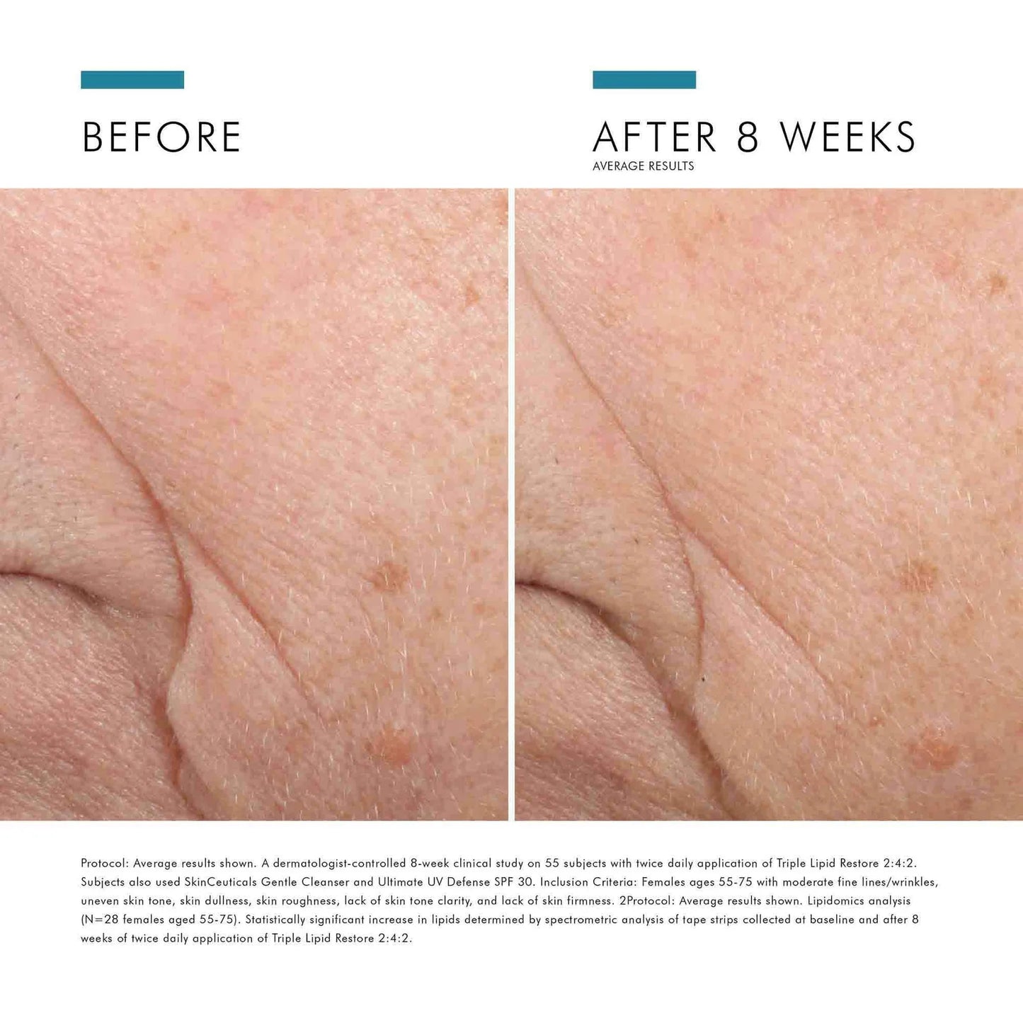 Triple Lipid Restore 2:4:2